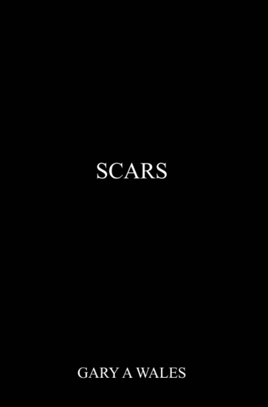 SCARS: for the ones that got away